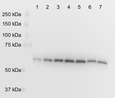 Western blot using anti-PGDH3 | Phosphoglycerate dehydrogenase 3 (chloroplastic) antibodies